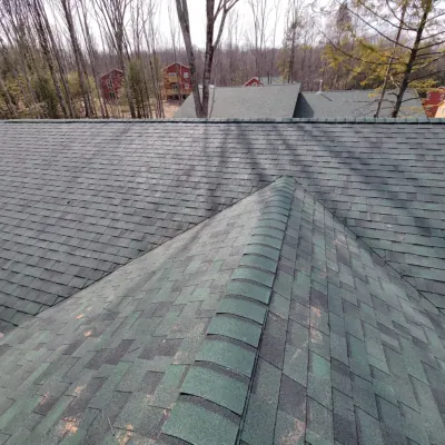 shingles