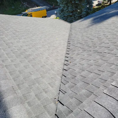 shingles
